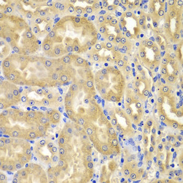 KO Validated Antibodies 1 Anti-XIAP Antibody CAB6869KO Validated