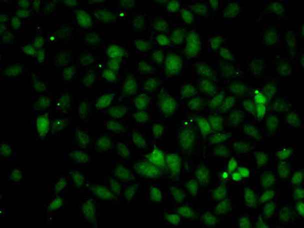 Immunology Antibodies 2 Anti-C1S Antibody CAB6878