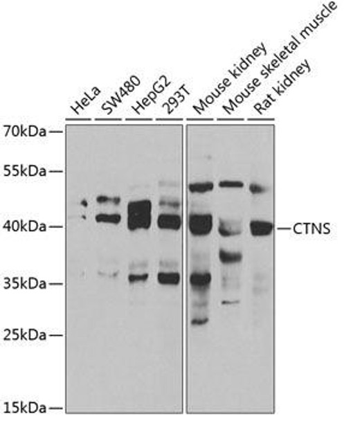 Metabolism Antibodies 2 Anti-CTNS Antibody CAB6893