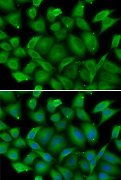 Immunology Antibodies 2 Anti-DEFA1 Antibody CAB6897