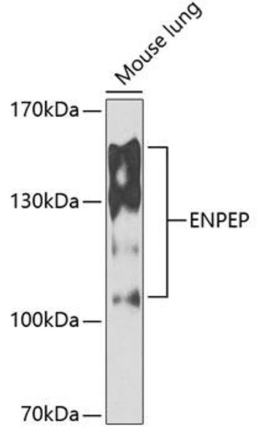 Cell Biology Antibodies 10 Anti-ENPEP Antibody CAB6905