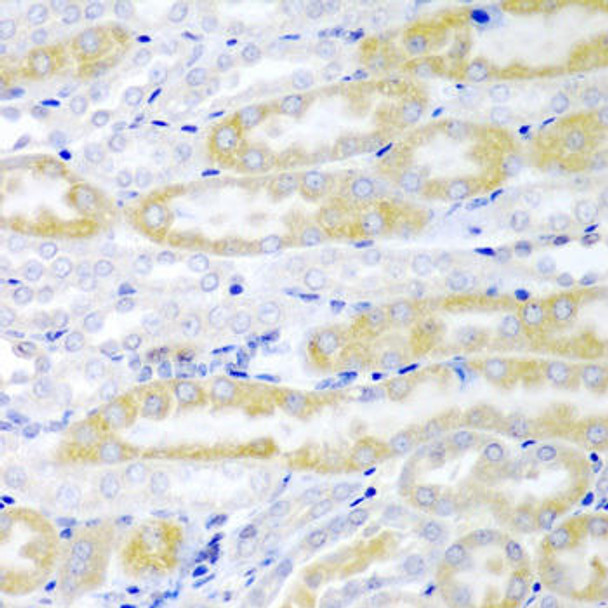 Cell Biology Antibodies 10 Anti-FABP6 Antibody CAB6906