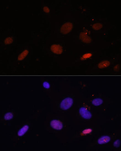 Cell Biology Antibodies 10 Anti-Histone H1.0 Antibody CAB6918