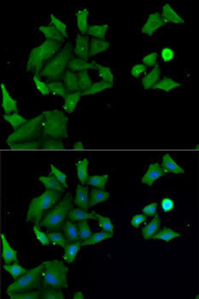 Cell Biology Antibodies 10 Anti-HABP2 Antibody CAB6919