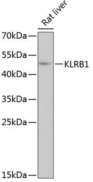 Cell Biology Antibodies 10 Anti-KLRB1 Antibody CAB6928