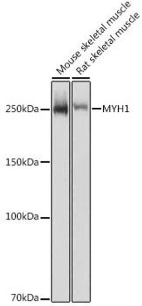 Cell Biology Antibodies 10 Anti-MYH1 Antibody CAB6935