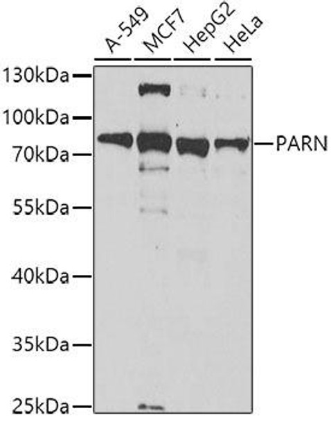 Epigenetics and Nuclear Signaling Antibodies 4 Anti-PARN Antibody CAB6941