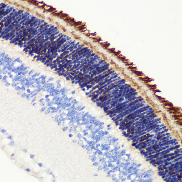 Signal Transduction Antibodies 3 Anti-PDE6B Antibody CAB6942