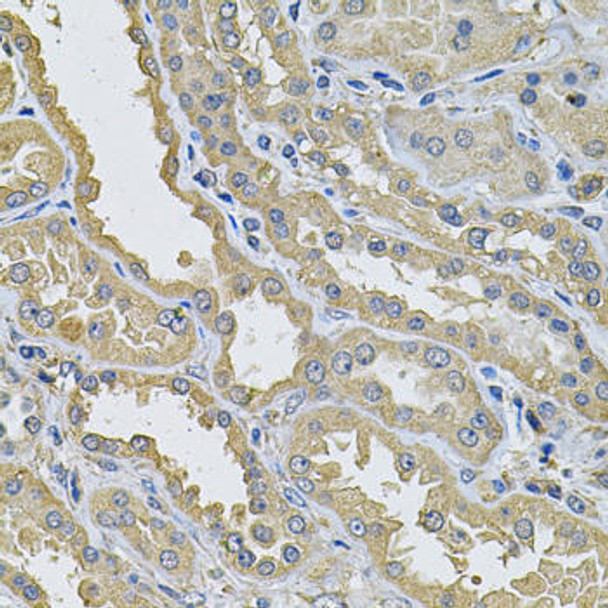 Cell Death Antibodies 2 Anti-PPID Antibody CAB6949