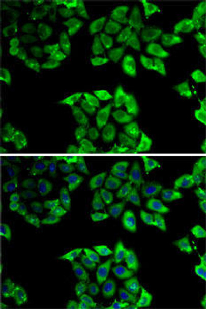 Cell Death Antibodies 2 Anti-PPID Antibody CAB6949