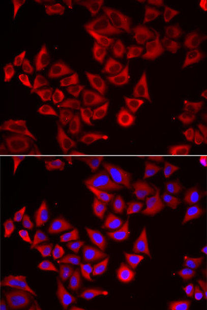 Cell Death Antibodies 2 Anti-SRGN Antibody CAB6951