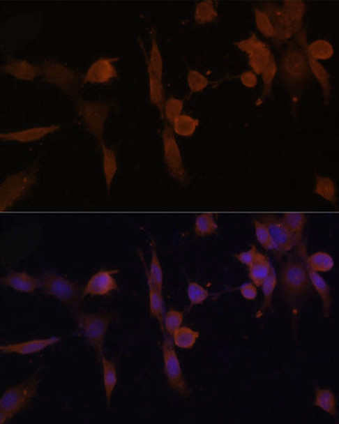 Metabolism Antibodies 2 Anti-PRKAB2 Antibody CAB6952