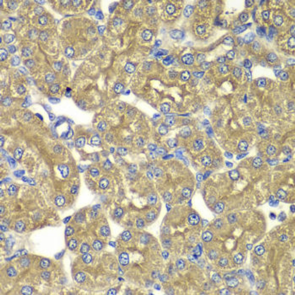 Cell Biology Antibodies 10 Anti-PSMD5 Antibody CAB6954