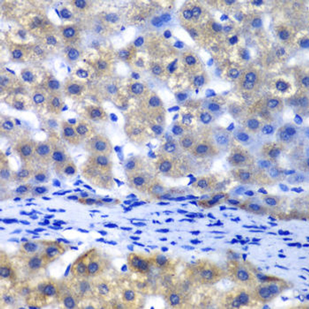 Cell Biology Antibodies 10 Anti-PSMD8 Antibody CAB6955