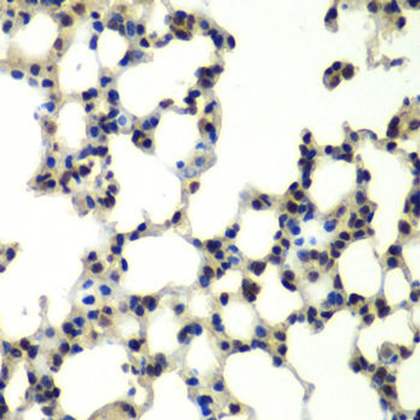 Cell Biology Antibodies 10 Anti-PSMD13 Antibody CAB6956