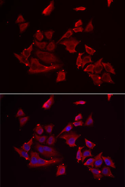 Cell Biology Antibodies 10 Anti-RARRES2 Antibody CAB6963