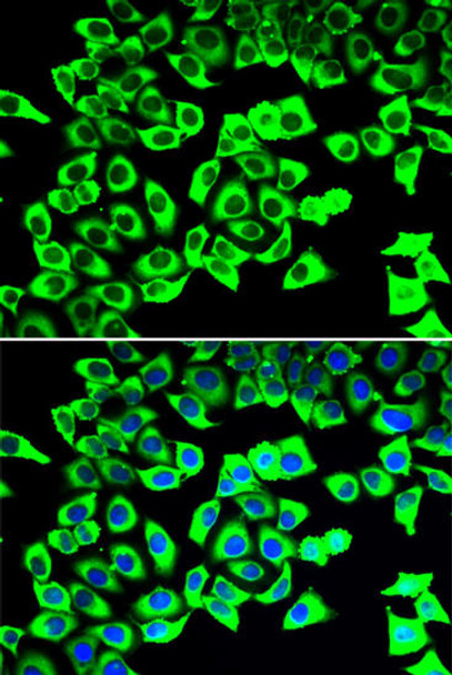 Cell Biology Antibodies 10 Anti-RPLP2 Antibody CAB6974