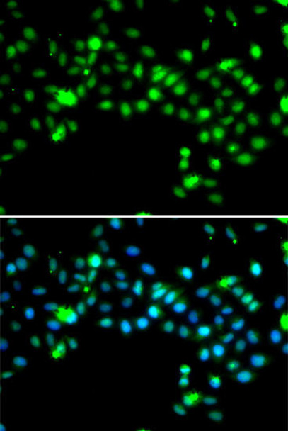 Epigenetics and Nuclear Signaling Antibodies 4 Anti-SRSF4 Antibody CAB6978