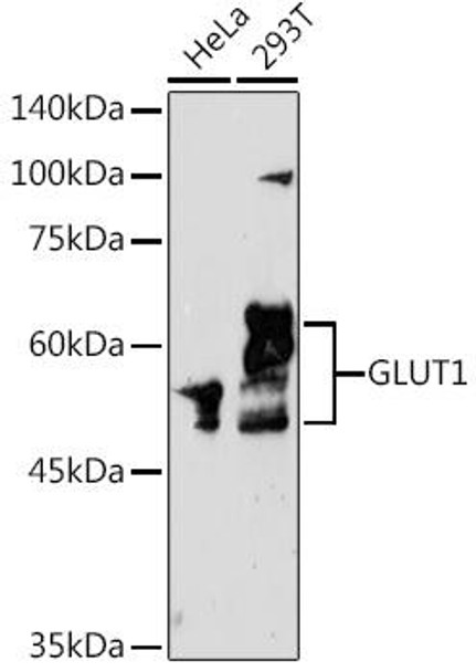 Signal Transduction Antibodies 3 Anti-GLUT1 Antibody CAB6982