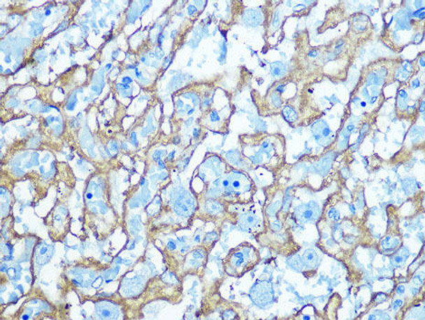 Signal Transduction Antibodies 3 Anti-GLUT1 Antibody CAB6982