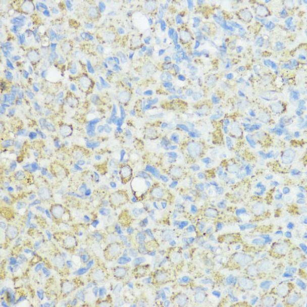 Cell Biology Antibodies 10 Anti-SOD3 Antibody CAB6984