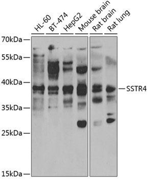 Cell Biology Antibodies 10 Anti-SSTR4 Antibody CAB6988