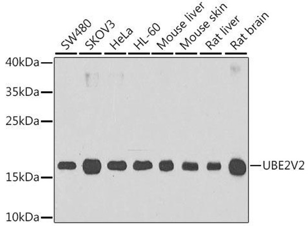 Signal Transduction Antibodies 3 Anti-UBE2V2 Antibody CAB6998