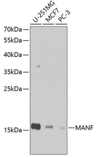 Metabolism Antibodies 2 Anti-MANF Antibody CAB7005