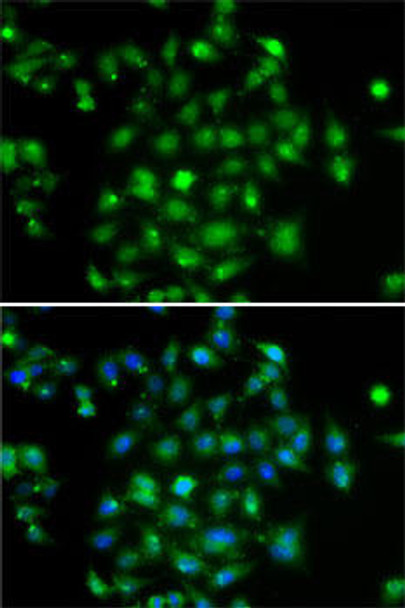 Cell Death Antibodies 2 Anti-DYRK2 Antibody CAB7012