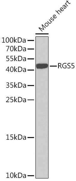 Cell Biology Antibodies 10 Anti-RGS5 Antibody CAB7015