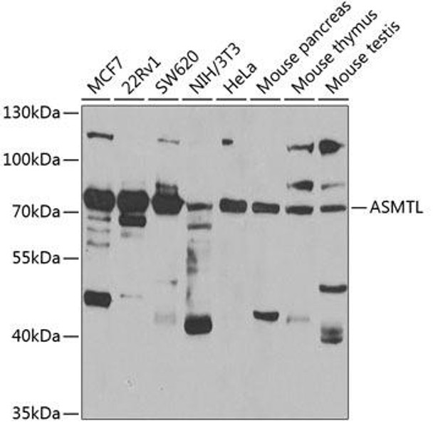 Metabolism Antibodies 2 Anti-ASMTL Antibody CAB7021