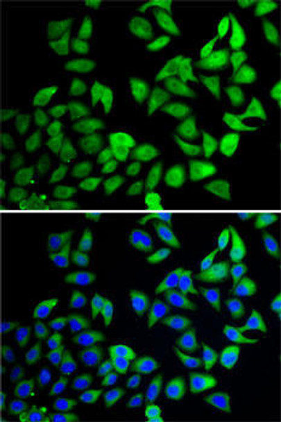 Cell Cycle Antibodies 2 Anti-USP8 Antibody CAB7031