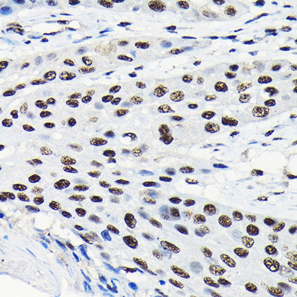 Epigenetics and Nuclear Signaling Antibodies 4 Anti-EFTUD2 Antibody CAB7040