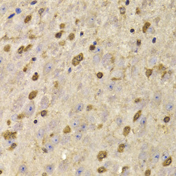 Developmental Biology Anti-QKI Antibody CAB7043