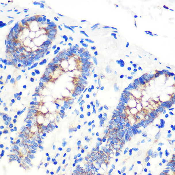 Cell Biology Antibodies 10 Anti-SCO2 Antibody CAB7051