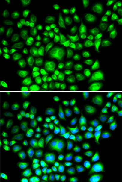 Cell Death Antibodies 2 Anti-BCAP31 Antibody CAB7056