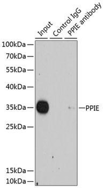 Epigenetics and Nuclear Signaling Antibodies 4 Anti-PPIE Antibody CAB7061