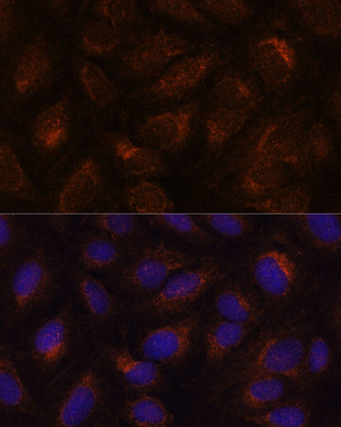 Cell Biology Antibodies 10 Anti-AGR2 Antibody CAB7064