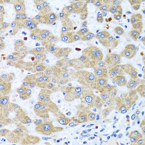 ChIP Antibodies Anti-NMU Antibody CAB7068