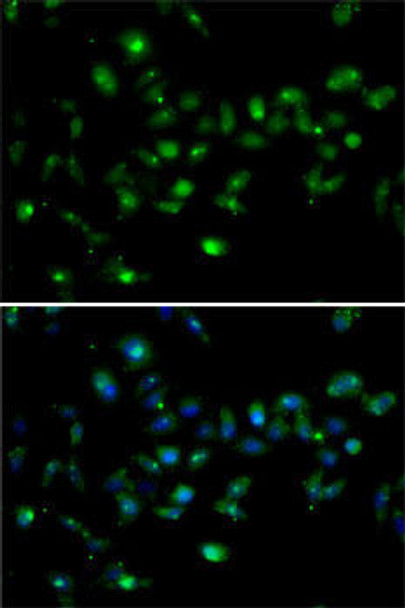 Epigenetics and Nuclear Signaling Antibodies 4 Anti-MORF4L1 Antibody CAB7071