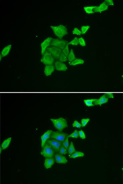 Cell Cycle Antibodies 2 Anti-TUSC2 Antibody CAB7075