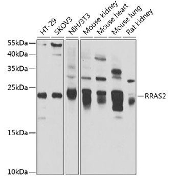 Cell Biology Antibodies 10 Anti-RRAS2 Antibody CAB7076