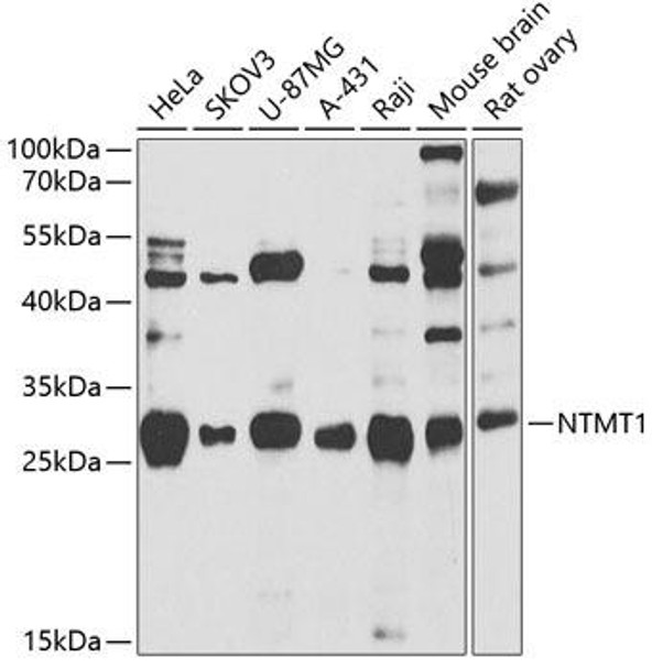 Cell Biology Antibodies 10 Anti-NTMT1 Antibody CAB7098