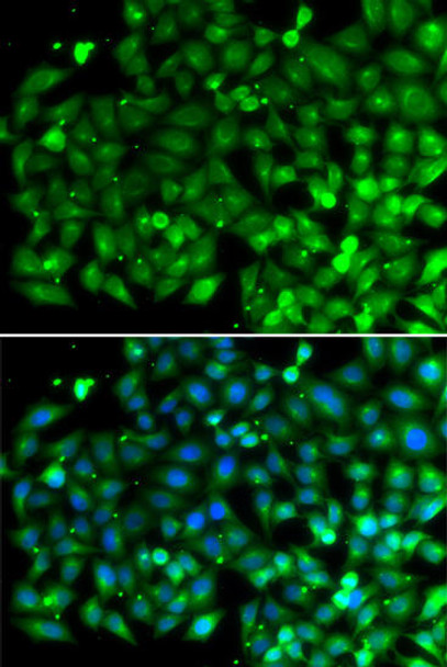 Cell Death Antibodies 2 Anti-Bif-1 Antibody CAB7104