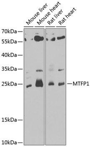 Cell Death Antibodies 2 Anti-MTFP1 Antibody CAB7110