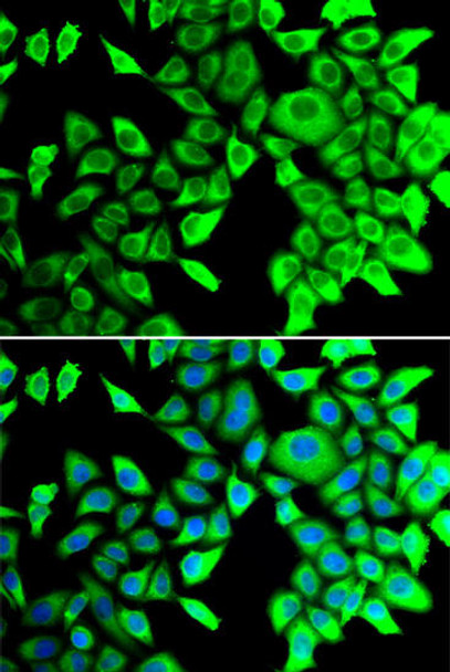 ChIP Antibodies Anti-THADA Antibody CAB7129