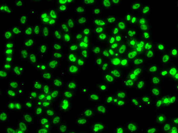 ChIP Antibodies Anti-CSRNP1 Antibody CAB7130