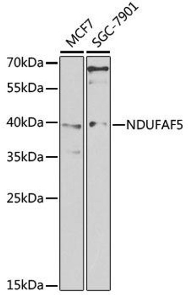 ChIP Antibodies Anti-NDUFAF5 Antibody CAB7135