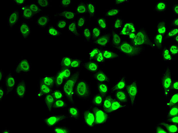 ChIP Antibodies Anti-FIP1L1 Antibody CAB7138