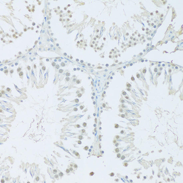 ChIP Antibodies Anti-FIP1L1 Antibody CAB7138